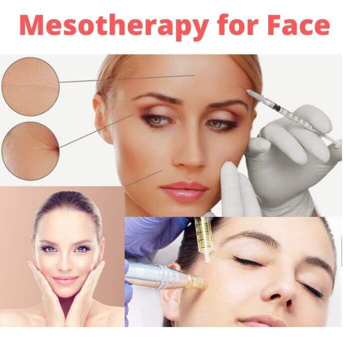 mesotherapy